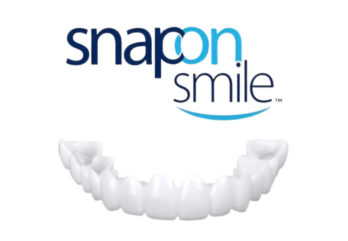 Carillas Dentales-snapon Smile
